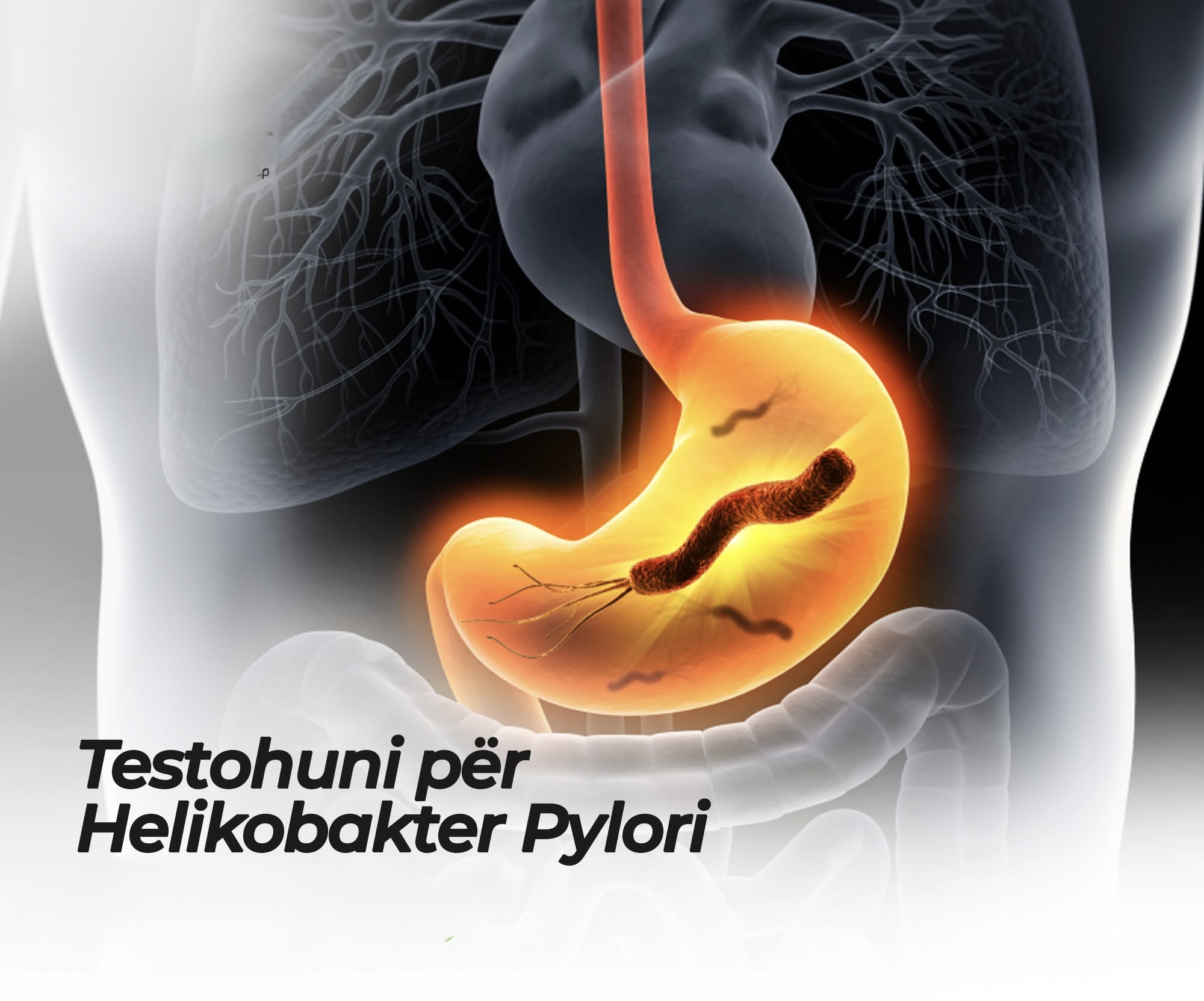 Helicobacter Pylori: Bakteri që prek miliona njerëz dhe simtomat që duhet të dini.