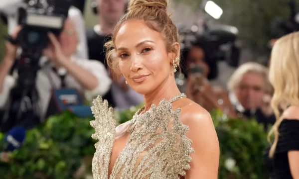 Jennifer Lopez pëson aksident teksa po përgatitej për një performancë, tregon mavijosjet në fytyrë