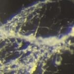 nje-revolucion-ne-bioelektronike:-eshte-zbuluar-nje-bakter-qe-percon-energjine-elektrike-si-nje-tel