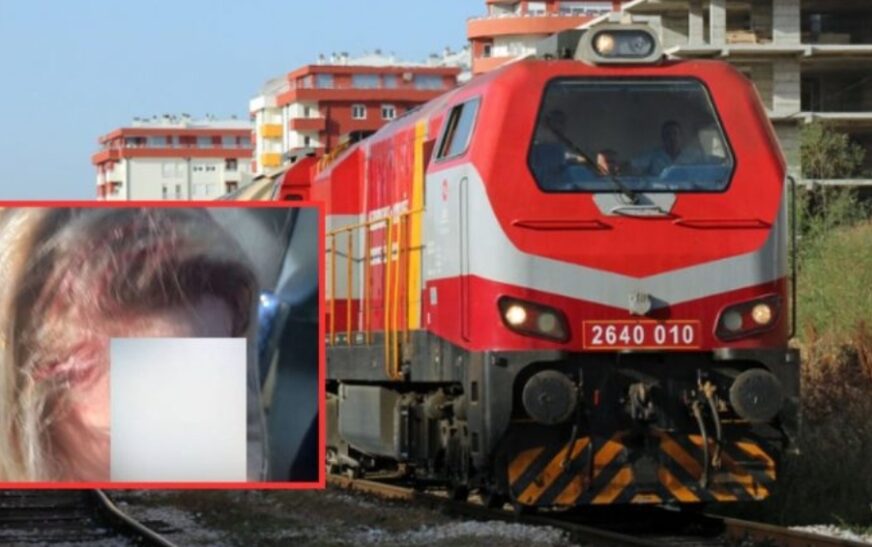 E rëndë: Kjo është 27-vjeçarja që u godit në kokë me gurë nga jashtë trenit në lëvizje – dërgohet urgjent në QKMF-Drenas