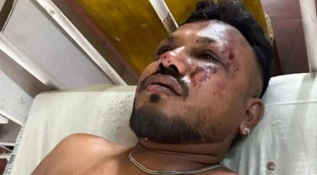 Një pasagjer i mbijetoi rrëzimit të aeroplanit në Indi, policia thotë se kishte kërcyer nga dalja emergjente