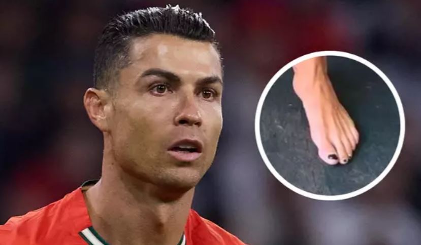 Pse Cristiano Ronaldo i lyen thonjtë e gishtave të këmbës?