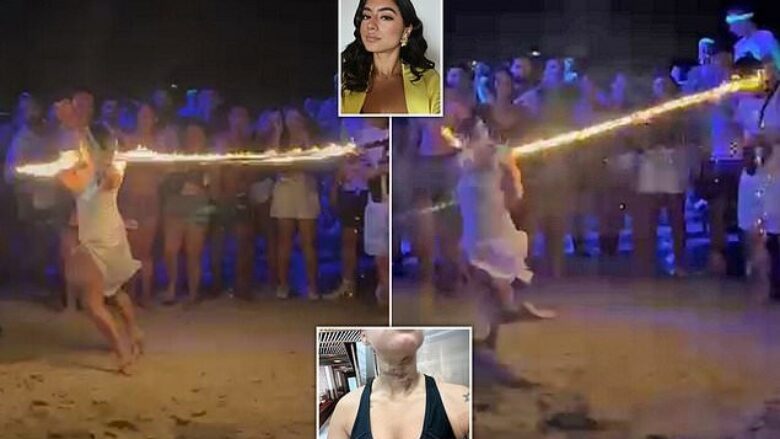 Moment i tmerrshëm kur britanikja pëson djegie të rënda pasi litari me zjarr i lidhet në qafë