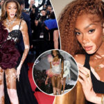 winnie-harlow:-nje-vajze-e-bullizuar-si-femije-qe-per-pak-la-shkollen-–-ndersa-sot-nje-modele-e-klasit-boteror-dhe-sipermarrese-e-suksesshme