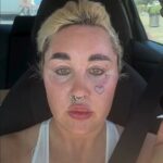 amanda-bynes-shfaq-pamjen-e-re-pas-nderhyrjeve-kozmetike-dhe-humbjes-se-peshes