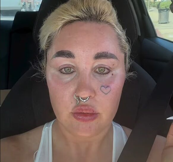Amanda Bynes shfaq pamjen e re pas ndërhyrjeve kozmetike dhe humbjes së peshës