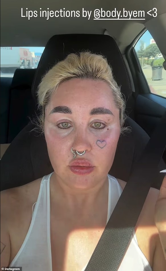 Amanda Bynes shfaq pamjen e re pas ndërhyrjeve kozmetike dhe humbjes së peshës