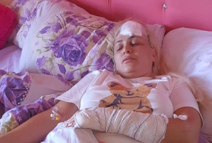 E RËNDË NË VUSHTRRI – Vajza denoncon babanë: “Më goditi me çekan në kokë”