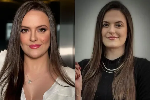 E reja nga Brazili vdes pas një reaksioni alergjik gjatë një skanimi rutinë