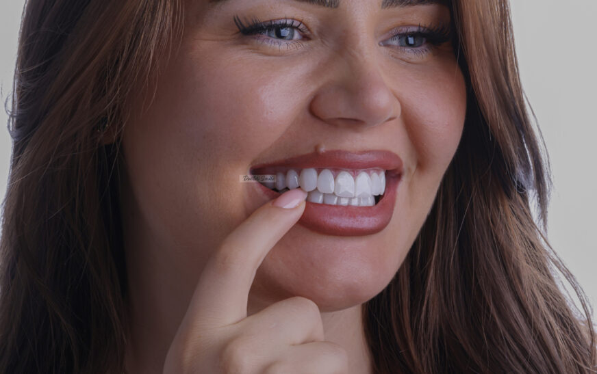 Buzëqeshje që ndriçon – vetëm me Diamond Veneers nga Doctor Smile