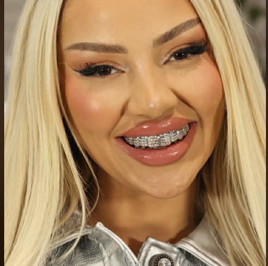 Benita surprizon me buzëqeshjen Doctor Smile në Big Brother