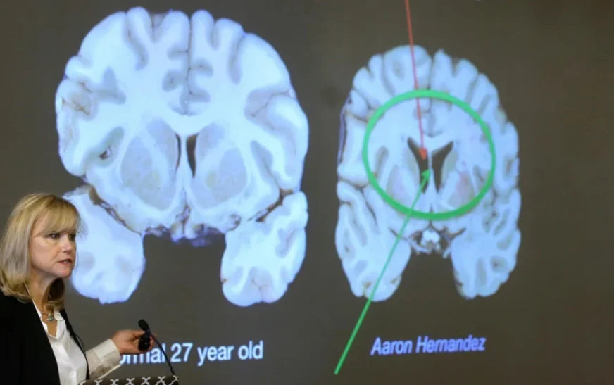 Zbulim i ri për trurin: Nuk është më ashtu siç mendohej deri tani