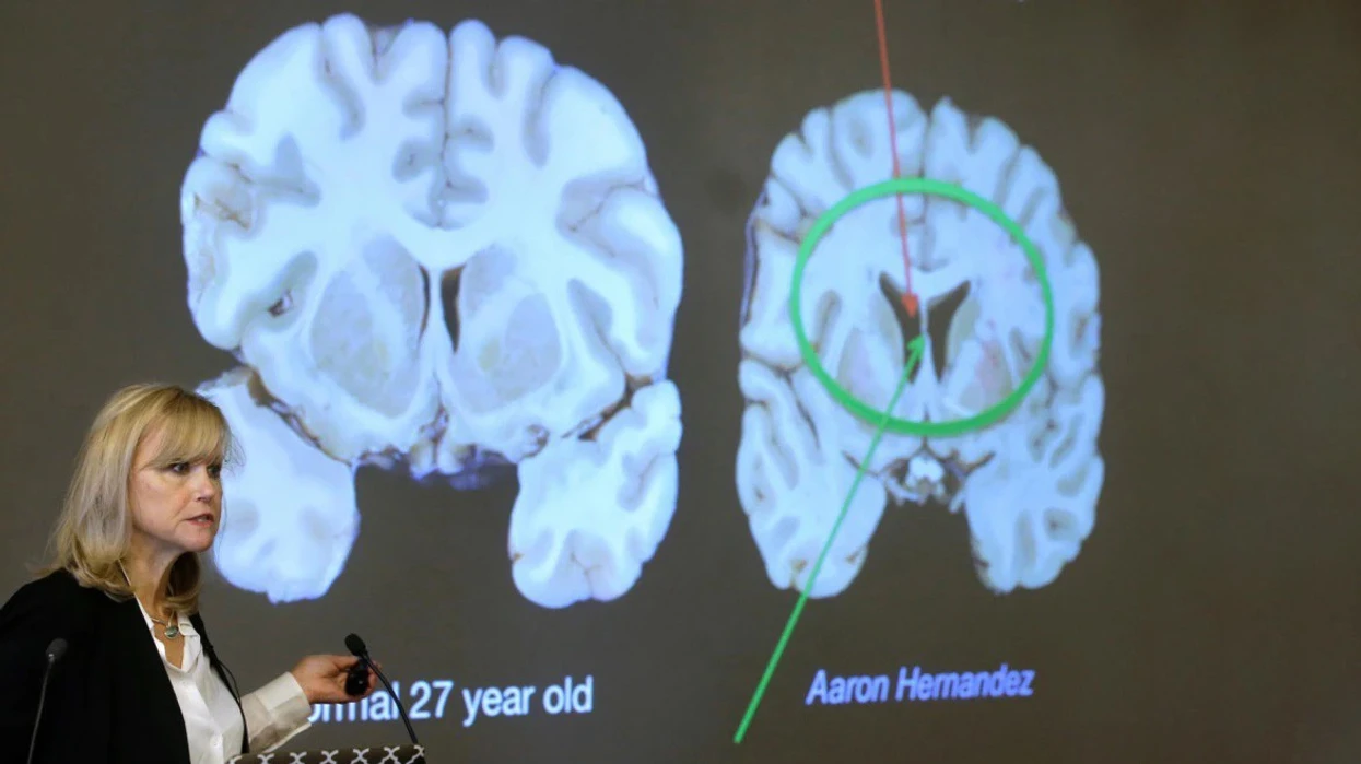 Zbulim i ri për trurin: Nuk është më ashtu siç mendohej deri tani