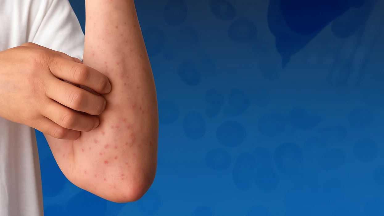 Një sëmundje e rrallë e gjakut që fillon me kruarje e djersitje – kërkon trajtim të menjëhershëm