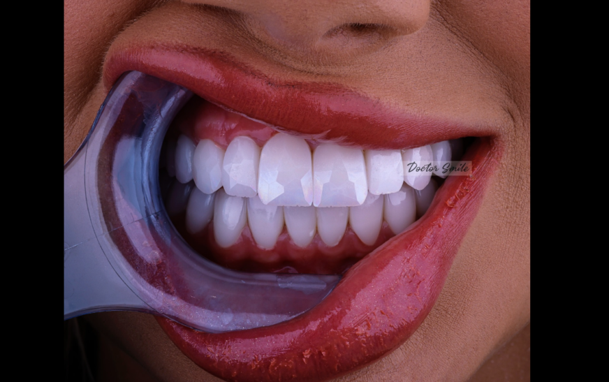 Sekreti i një buzëqeshjeje perfekte? Doctor Smile!