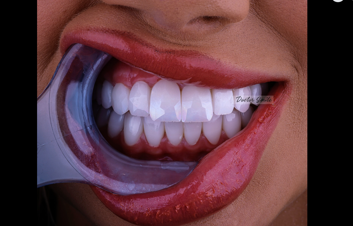 Sekreti i një buzëqeshjeje perfekte? Doctor Smile!