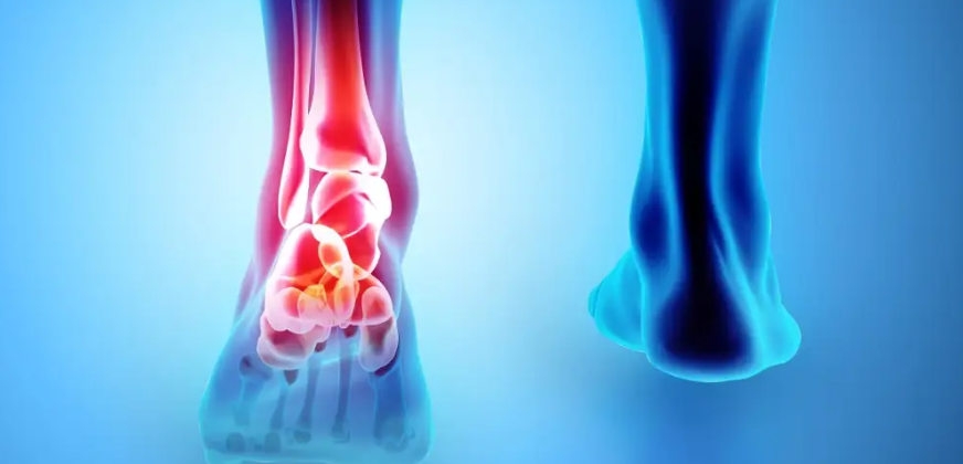 Kujdesi për tendinat: si të parandaloni dëmtimet dhe dhimbjet