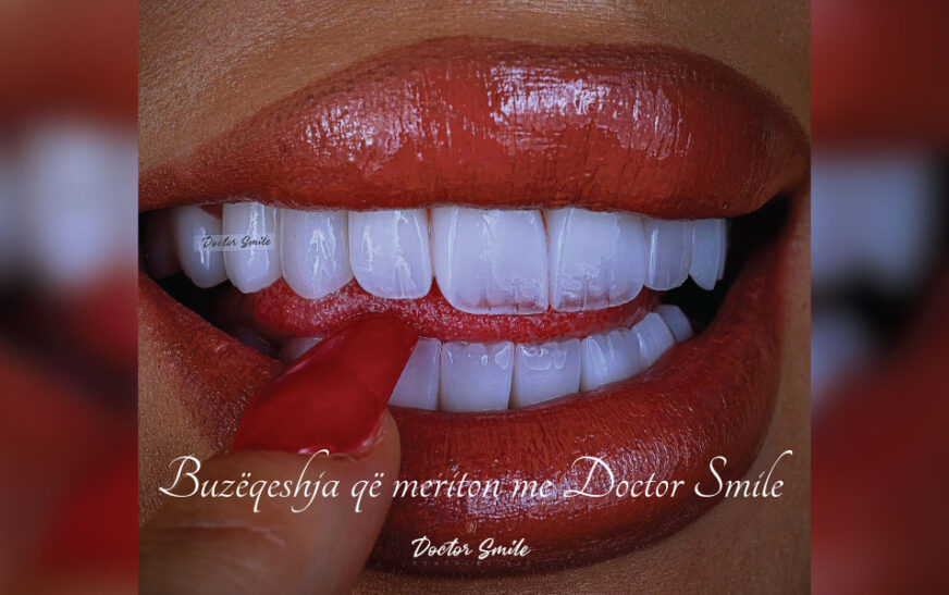 Doctor Smile vendi ku perfeksioni është praktikë e përditshme