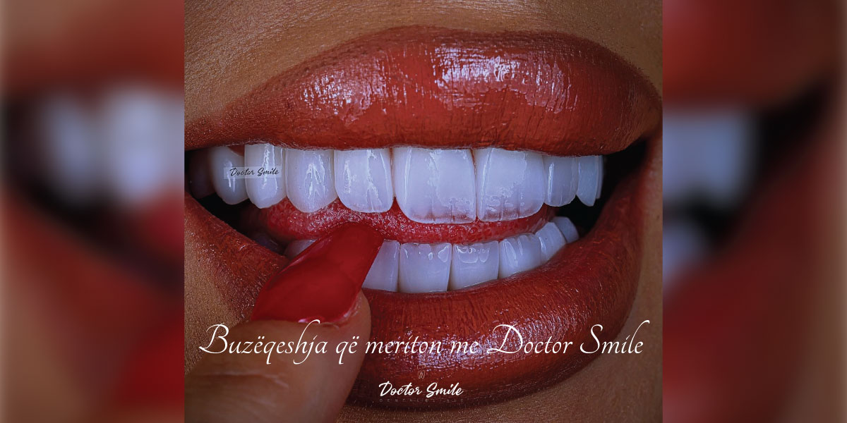 Doctor Smile vendi ku perfeksioni është praktikë e përditshme