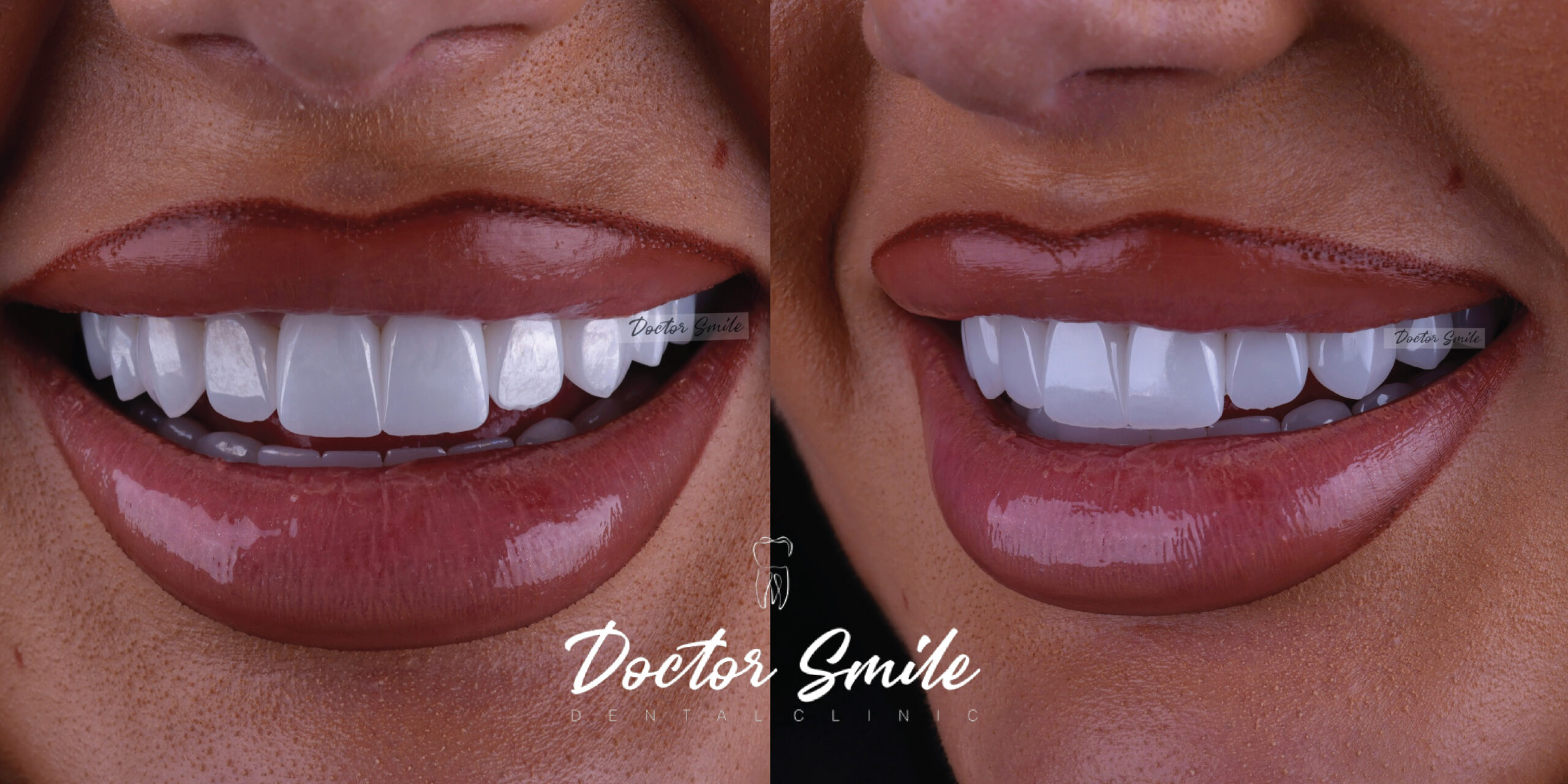 Zbulo buzëqeshjen tënde te Doctor Smile