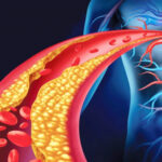 hulumtimi:-kolesteroli-i-larte-shoqerohet-me-jetegjatesi-me-te-madhe