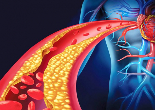 Hulumtimi: Kolesteroli i lartë shoqërohet me jetëgjatësi më të madhe