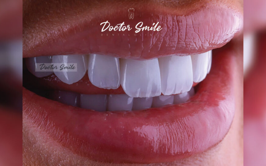 Doctor Smile shembull i ekselencës dentare në Kosovë