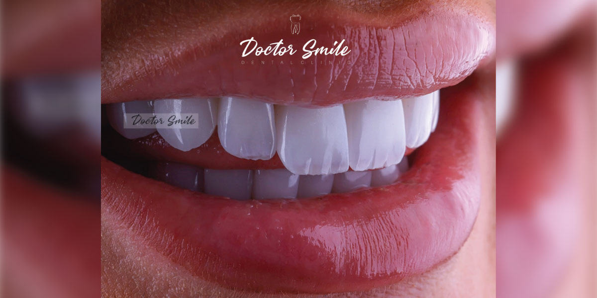 Doctor Smile shembull i ekselencës dentare në Kosovë