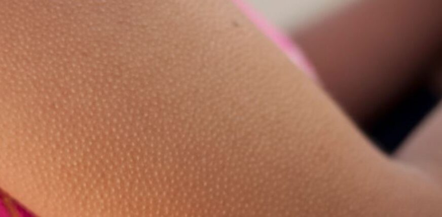 Ethet në trup, ja çfarë tregojnë për shëndetin