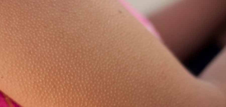 Ethet në trup, ja çfarë tregojnë për shëndetin