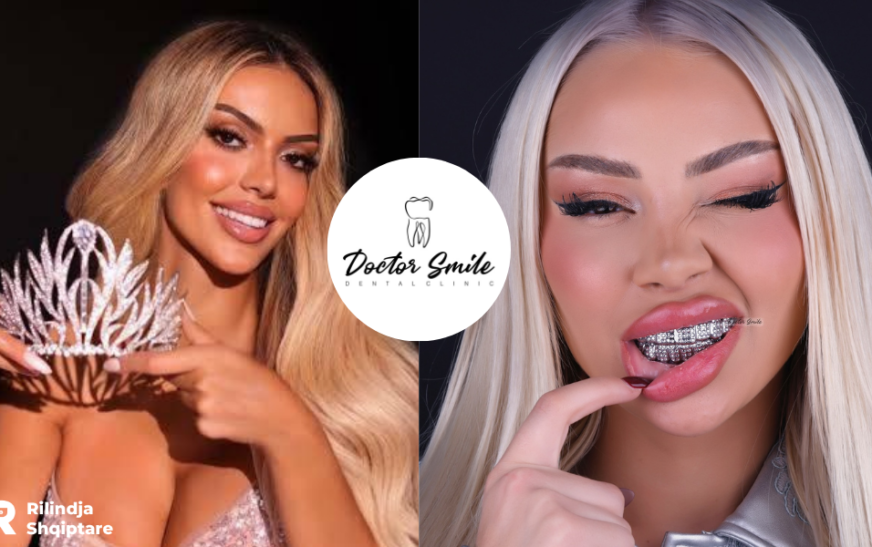 Kush fshihet pas buzëqeshjeve perfekte të VIP-ave shqiptarë?