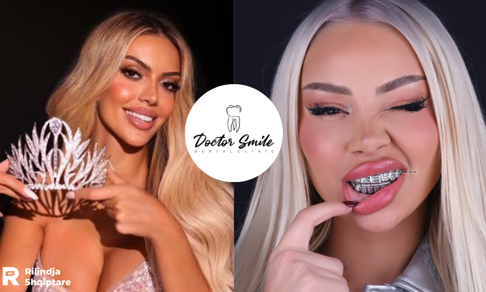 Kush fshihet pas buzëqeshjeve perfekte të VIP-ave shqiptarë?