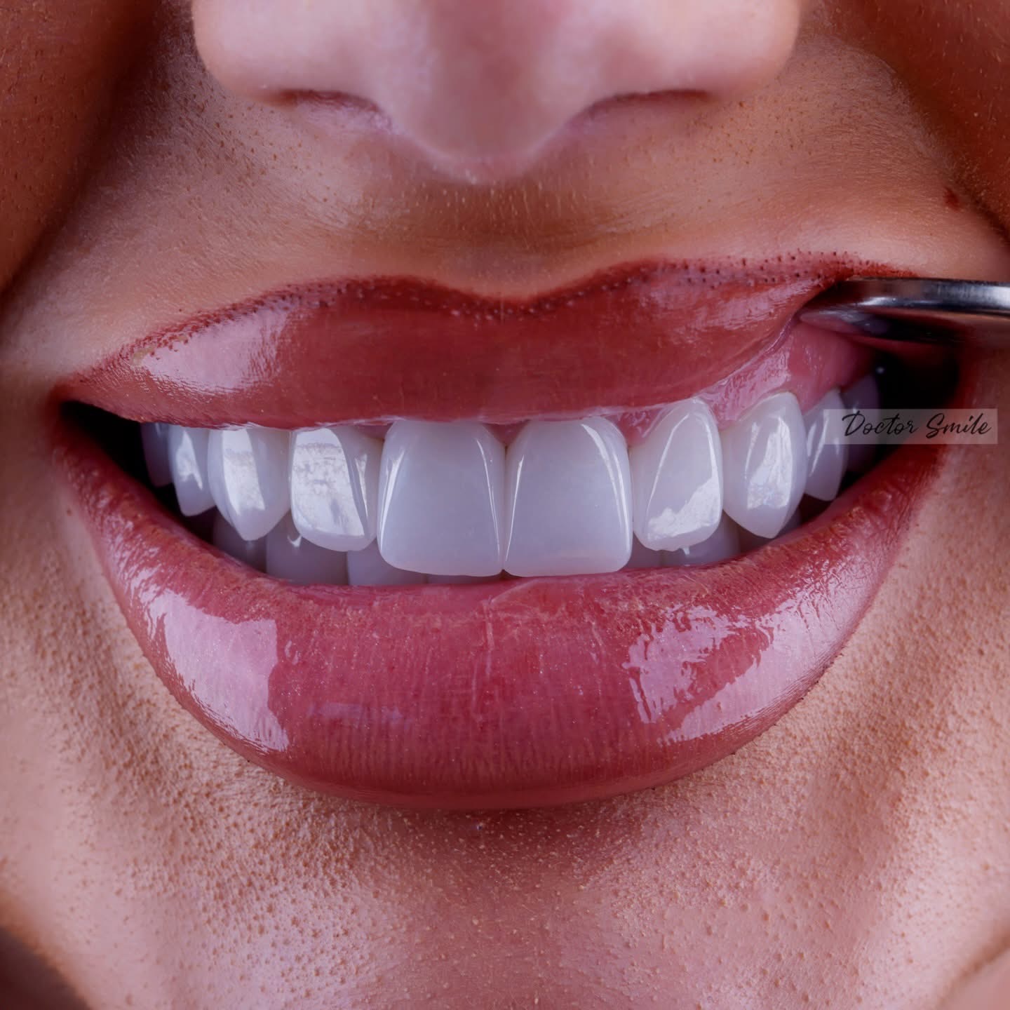 Doctor Smile – buzëqeshja perfekte nis me kujdesin profesional