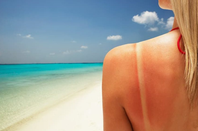 Kujdesi dermatologjik në verë: Si të mbrojmë lëkurën nga dëmtimet e diellit?