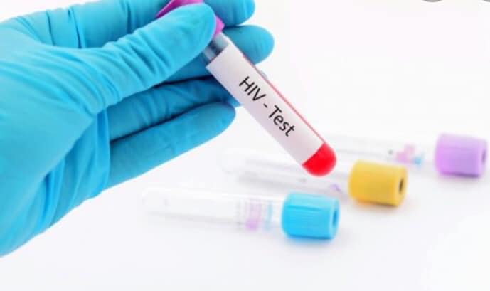 Dy viktima dhe 21 raste të reja me HIV, infektologia: Qytetarët ende nuk janë të vetëdijshëm për rrezikun