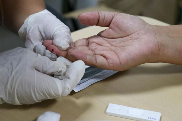 21 raste të reja me HIV/AIDS në Kosovë gjatë vitit 2026, dy persona humbën jetën