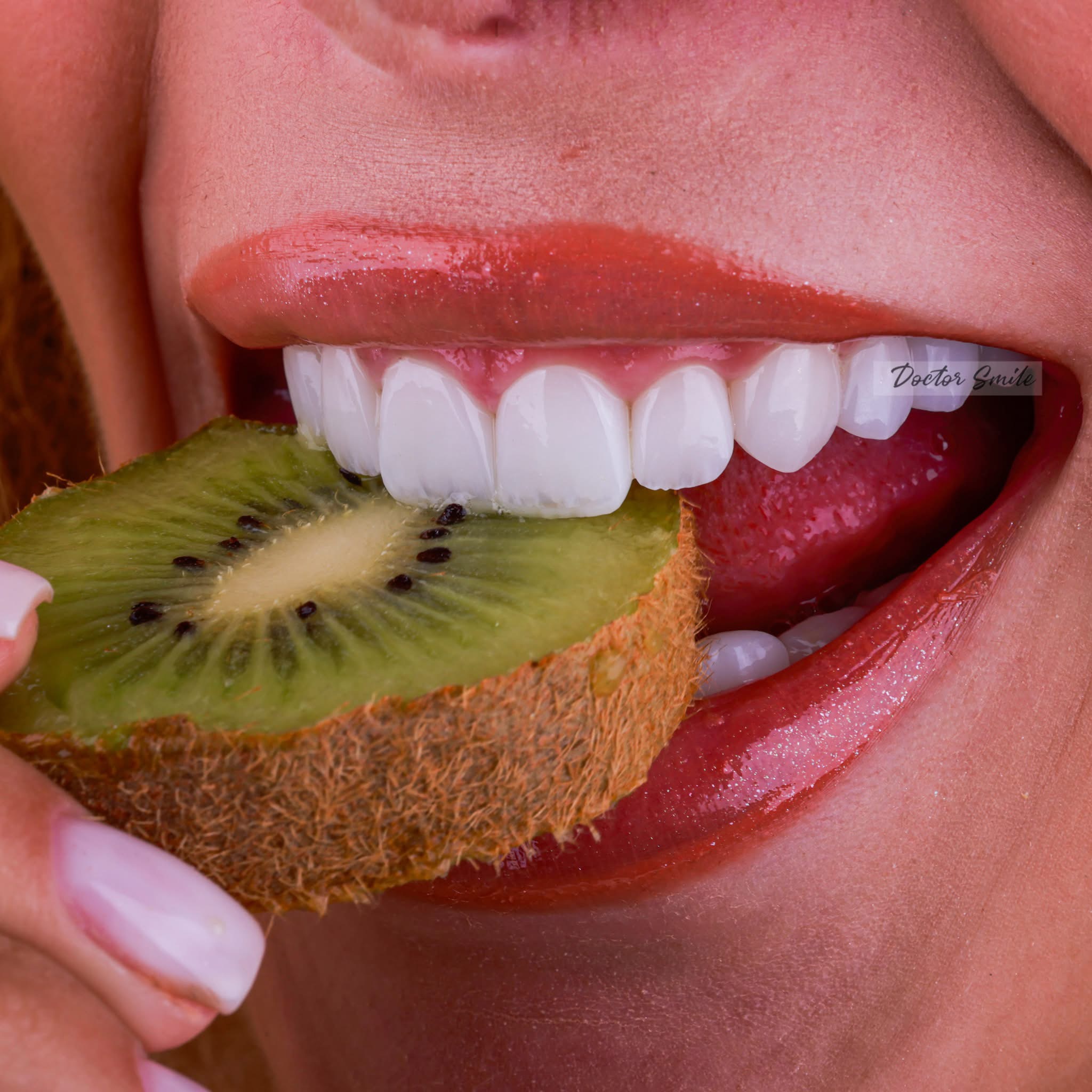Buzëqeshja që meritoni: Dr. Valton Rrustemi dhe Doctor Smile po e kthejnë estetikën dentare në art