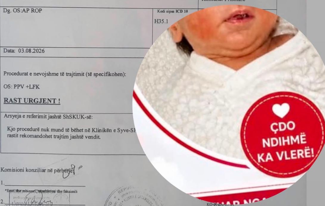 Thirrje për ndihmë për vogëlushin Nur Haxholli: Një shpresë për shikimin e tij varet nga solidariteti ynë