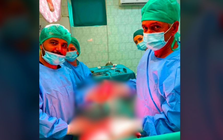 Ndërhyrje e rrallë në Pejë, mjekët largojnë tumorin pranë strukturave kryesore vaskulare –