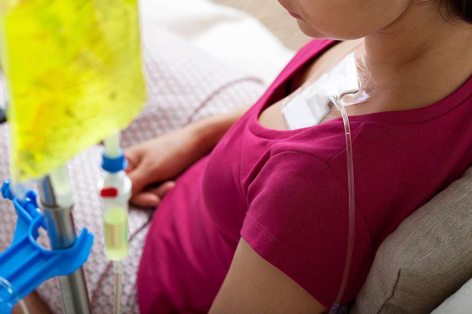 Këto janë llojet e kancerit që shkaktojnë më së shumti vdekje te burrat dhe gratë –